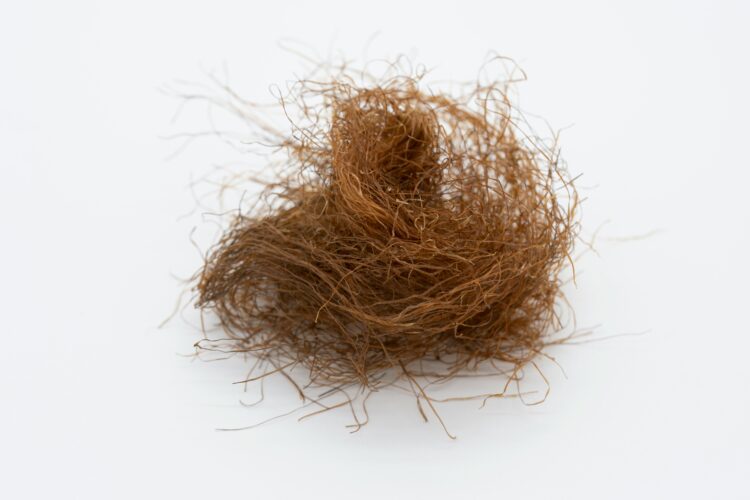 1 az eltűnő tincsek nyomában – az alopecia