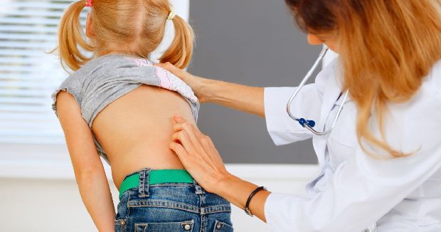 1 scoliosis (1)